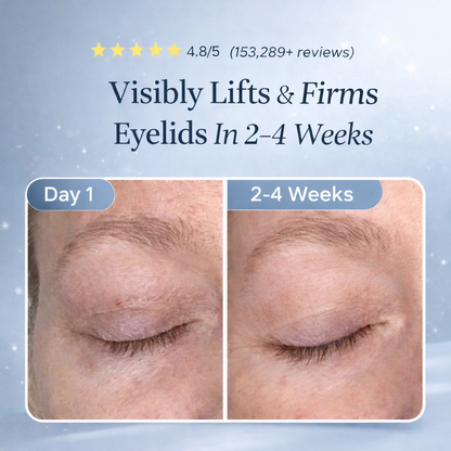 Lid Lifting Treatment