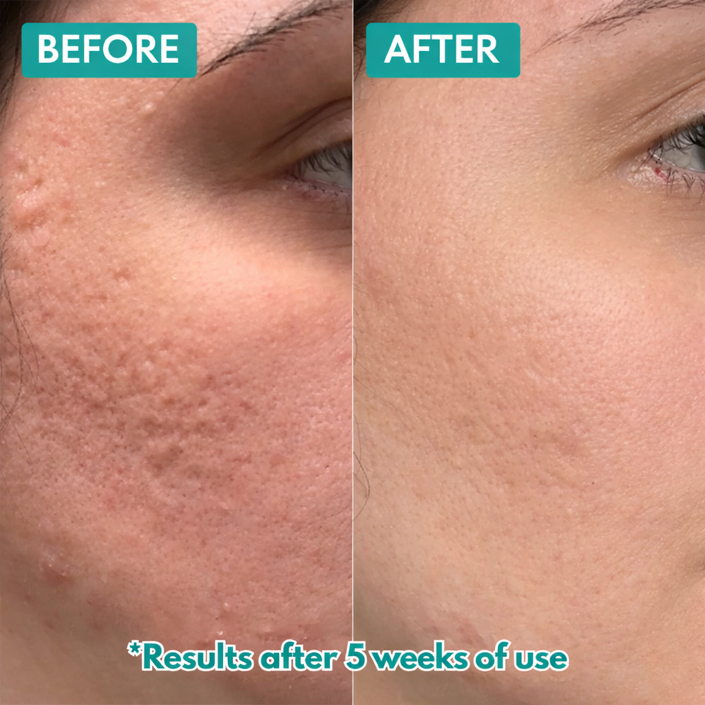 MicroCrystal Renewal Duo by Maple & Ivy